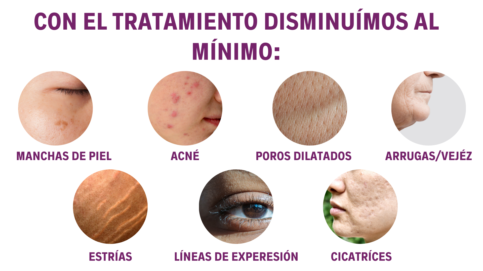 POROS DILATADOS